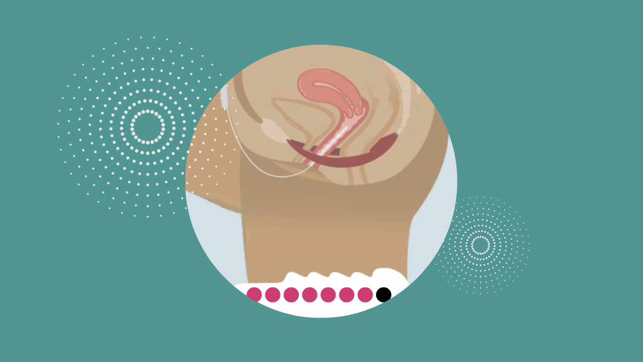 Squeezing your pelvic floor